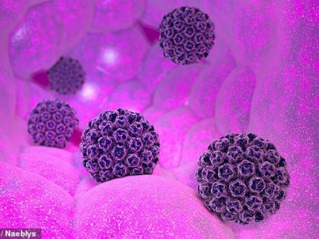 Sức khỏe đời sống - "Lợi dụng" virus đường tình dục, phát hiện ung thư sớm 40 năm