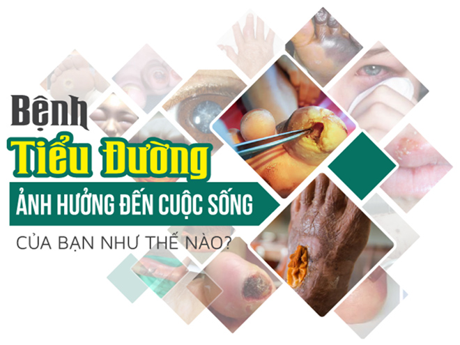 Phúc An Đường – Cái phao cứu sinh cho người bị tiểu đường - 1