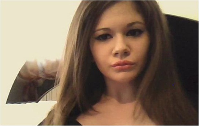 Tiêm axit vào môi để giống búp bê, cô gái bị chê như... quái vật - 3