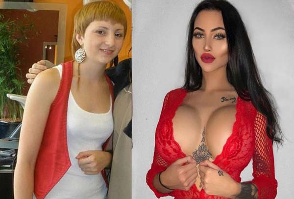 Vẻ đẹp ấn tượng sau dao kéo của người phụ nữ từng bị gọi là "con cóc xấu xí" - 3