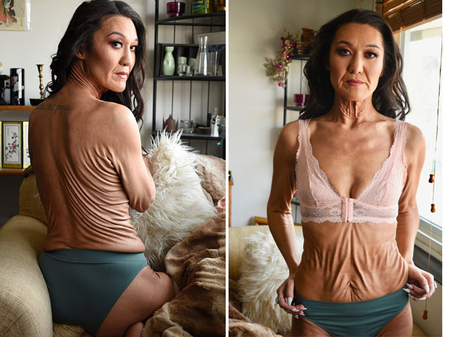 Bạn trẻ - Cuộc sống - Bạn có tin cô gái có làn da chảy xệ này chỉ mới 28 tuổi?