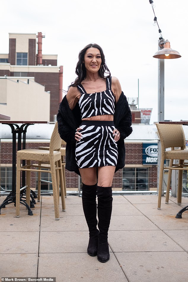 Bạn có tin cô gái có làn da chảy xệ này chỉ mới 28 tuổi? - 4