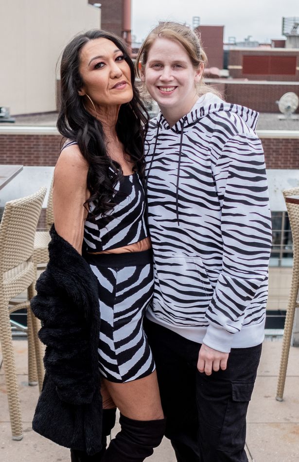 Bạn có tin cô gái có làn da chảy xệ này chỉ mới 28 tuổi? - 3