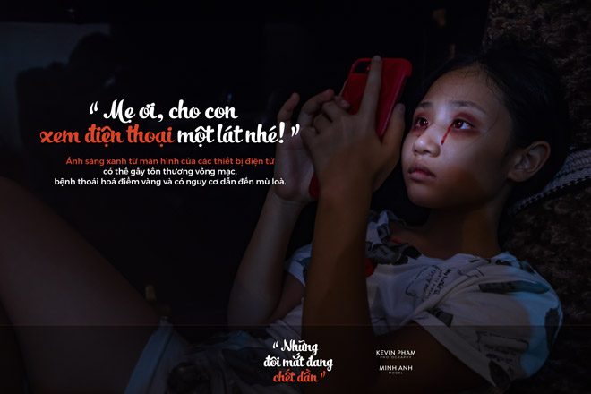 Bố mẹ khiến đôi mắt của trẻ đang chết dần - 7