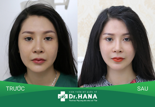 Bác sĩ Nguyễn Công Hân: "Cần xác định rõ tình trạng lão hóa mới chọn được dịch vụ phù hợp" - 4