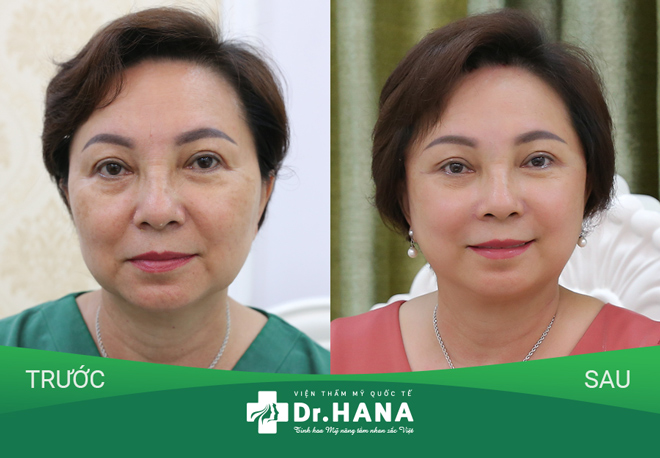 Bác sĩ Nguyễn Công Hân: "Cần xác định rõ tình trạng lão hóa mới chọn được dịch vụ phù hợp" - 5