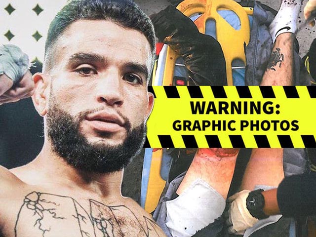 Thể thao - SAO MMA tàn nghiệp vì tai nạn thảm khốc: Suýt cưa chân, vác đơn đi kiện