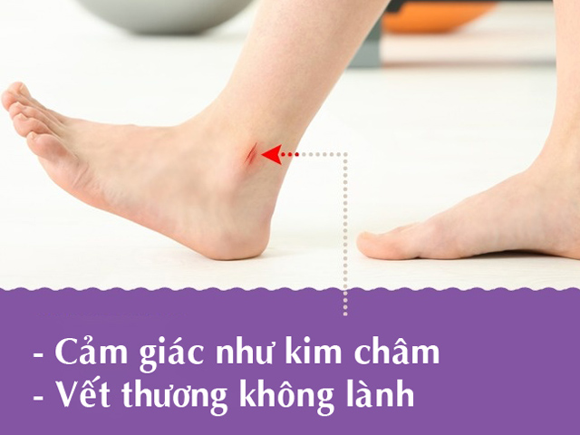 Sức khỏe đời sống - 9 dấu hiệu ở chân chỉ ra bạn mắc bệnh nguy hiểm, chẳng thể coi thường
