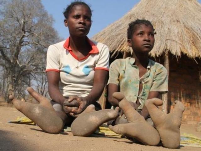 Bộ lạc ”chân đà điểu” kỳ lạ ở châu Phi