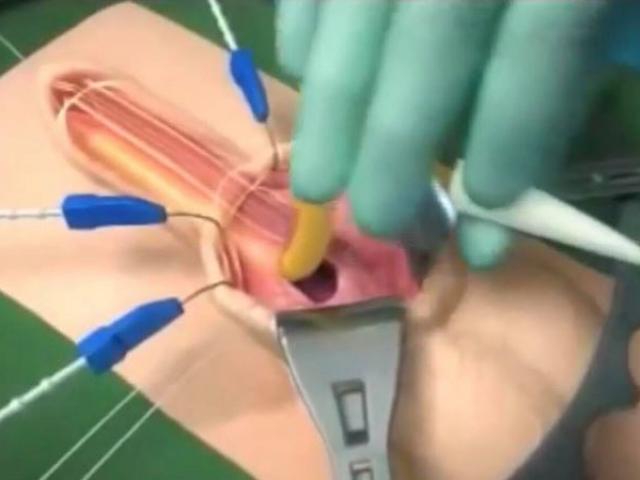 Sức khỏe đời sống - Dùng "công tắc" điều khiển "cậu nhỏ" theo ý muốn