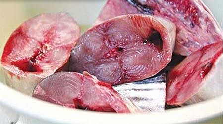 Những thực phẩm ‘tồi tệ’ cho não - 3