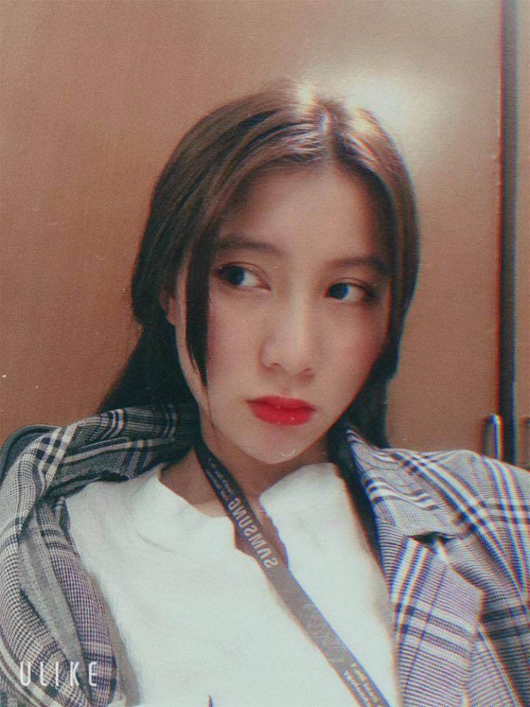 Cô nàng mặt sẹo tìm lại làn da trơn láng, tự tin khoe đường nét khả ái - 4