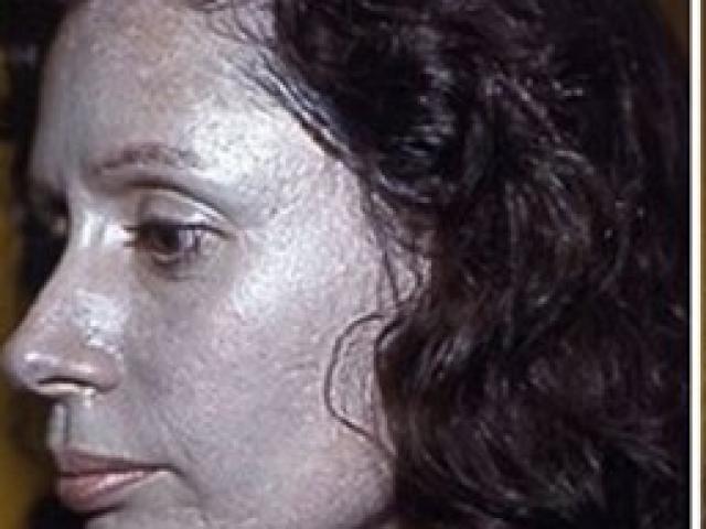 Sức khỏe đời sống - Con trai cứu bố nhờ tinh chất bạc: Cẩn trọng kẻo... bạc mặt!