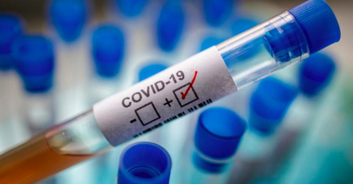 Thế giới - Mỹ cấp phép dụng cụ xét nghiệm phát hiện COVID-19 trong 2 phút