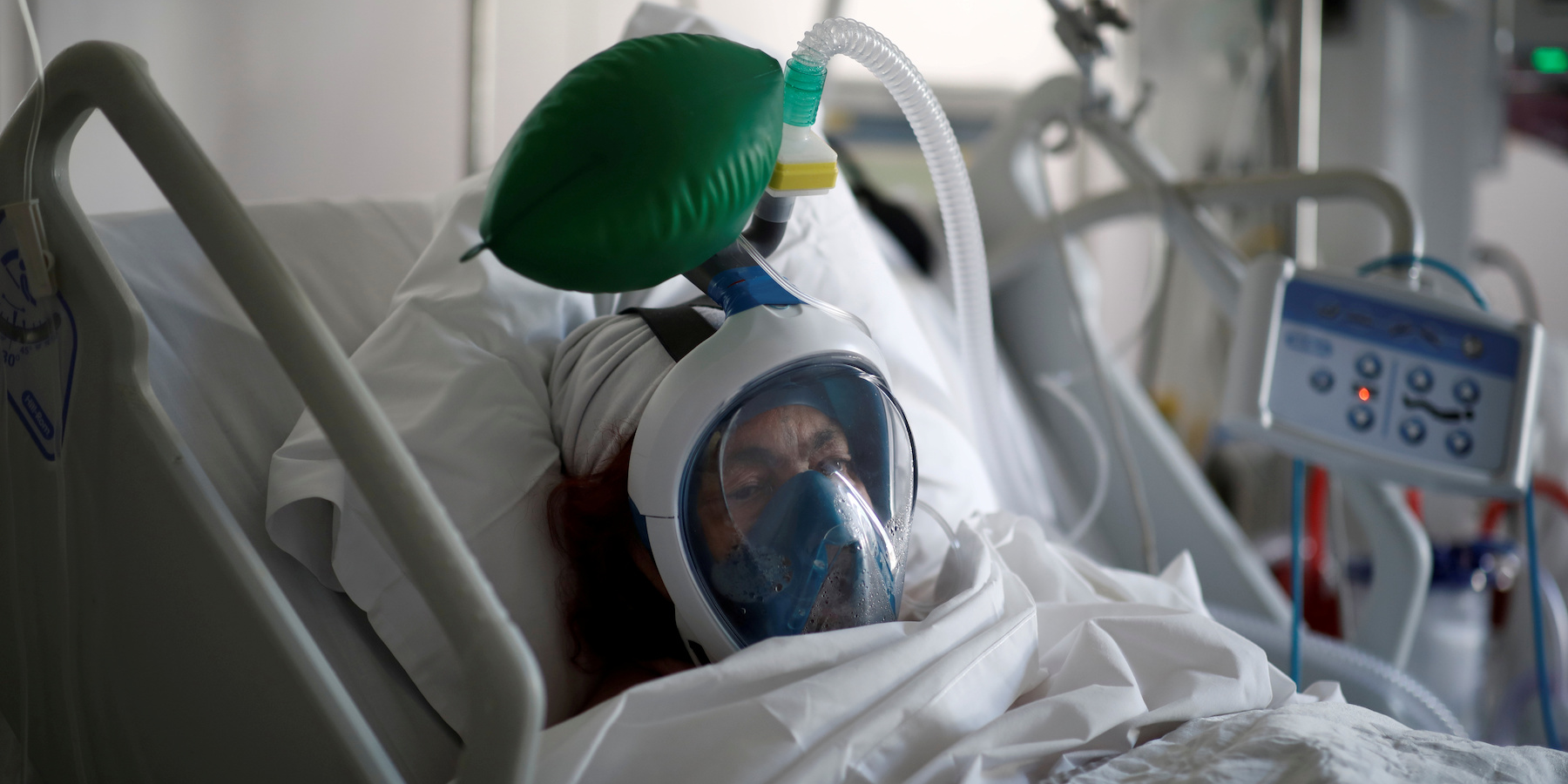 Một bệnh nhân nhiễm Covid-19 đang được dùng máy thở tại Pháp (ảnh: Businessinsider)