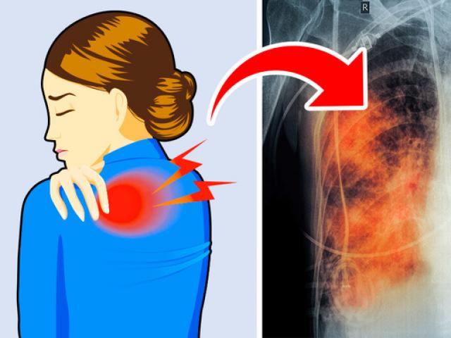 Sức khỏe đời sống - Có 5 dấu hiệu này chứng tỏ phổi của bạn đang "kêu cứu", tuyệt đối không được chủ quan