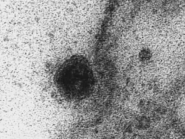 Lần đầu ghi được chính xác thời điểm virus SARS- CoV-2 xâm nhập tế bào khỏe mạnh