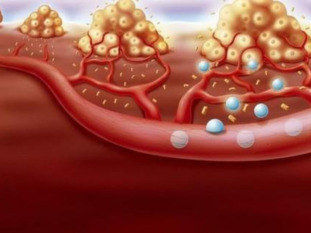 Sức khỏe đời sống - 4 dấu hiệu cho thấy máu của bạn "dính như cháo", rất nguy hiểm