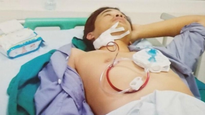 Cháu Mai Thế Duy, nạn nhân trong vụ hành hung ngày 18/11/2014.