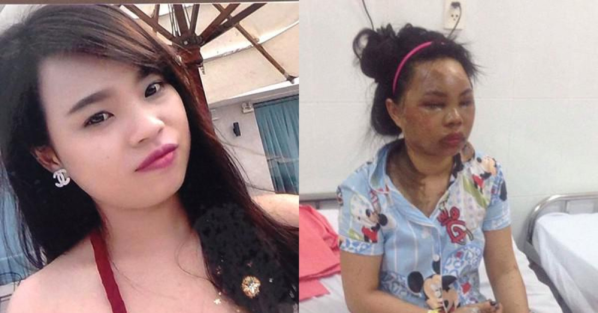 Pháp luật - Nỗi đau của cả gia đình bị tạt acid