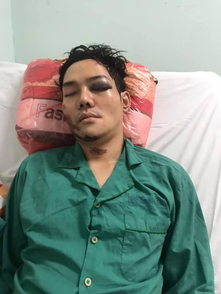 Con trai nuôi Hoài Linh gặp tai nạn nghiêm trọng, đa chấn thương, đặc biệt là phần đầu.