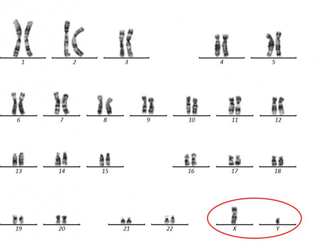 Sau 4 năm chạy chữa vô sinh, 2 vợ chồng sốc nặng khi bất ngờ biết đến nguyên nhân - 2