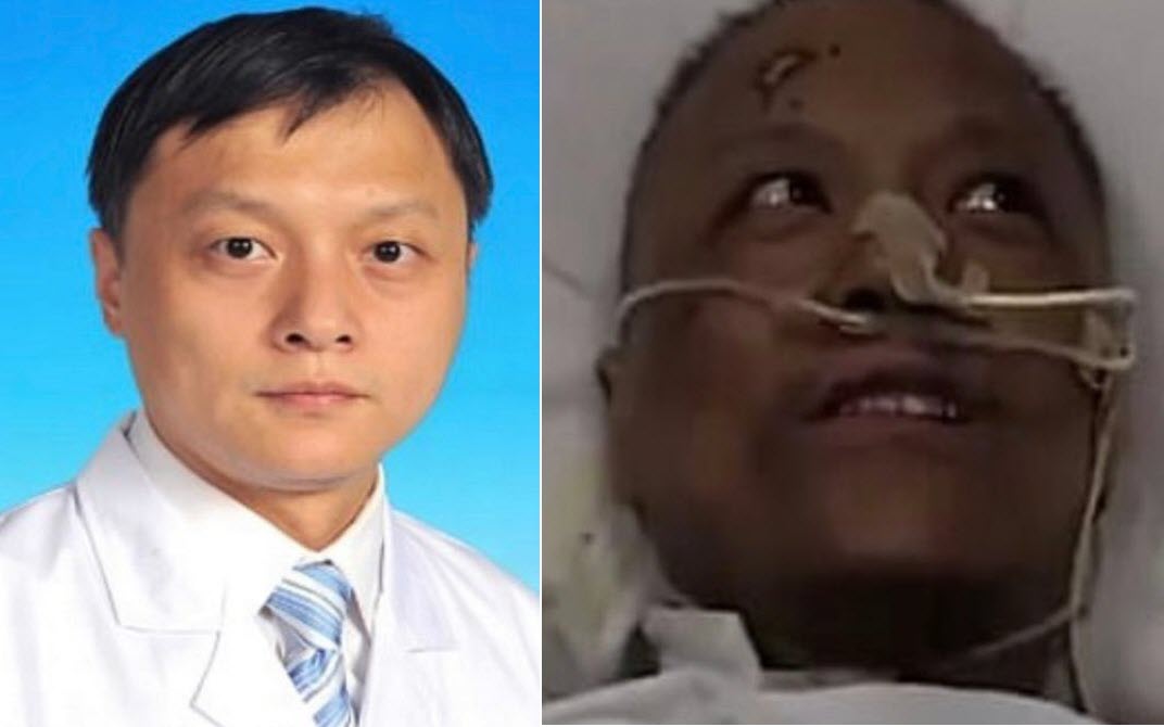 Bác sĩ Yi Fan trước và sau khi bị nhiễm Covid-19 một thời gian
