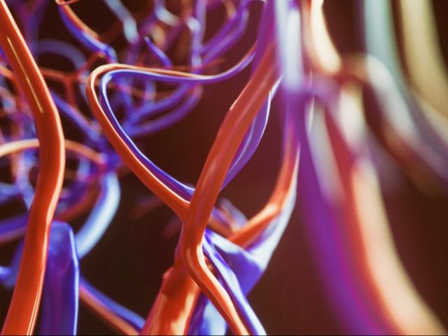 Thế giới - Covid-19: Phát hiện SARS-CoV-2 tấn công mạch máu trên khắp cơ thể