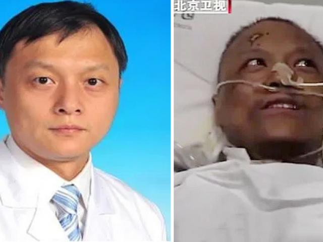 Sức khỏe đời sống - Hai bác sĩ Trung Quốc nhiễm Covid-19 thoát chết nhưng da đổi màu nâu
