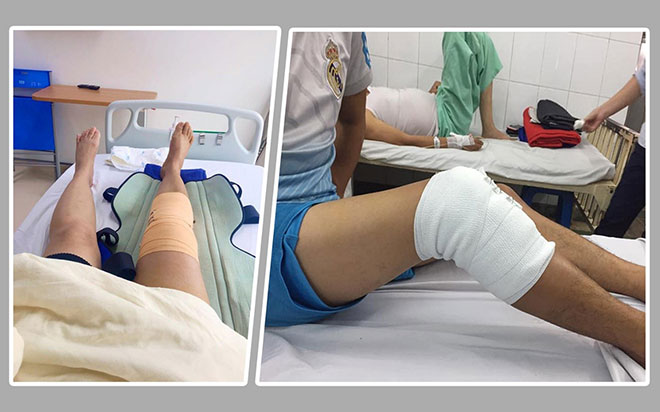 Sau mổ tái tạo dây chằng nên ăn gì để phục hồi nhanh - 1