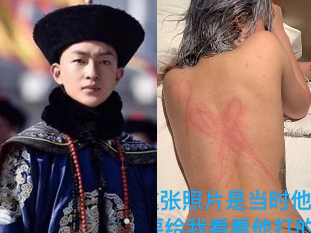 Đời sống Showbiz - "Ngũ A Ca" bị tố bạo hành bạn gái, có sở thích chăn gối kì quái