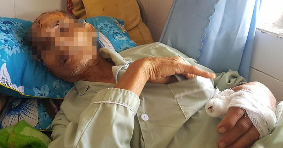 Pháp luật - Người cha bị con cháu đánh nguy kịch vì định bán đất chữa bệnh