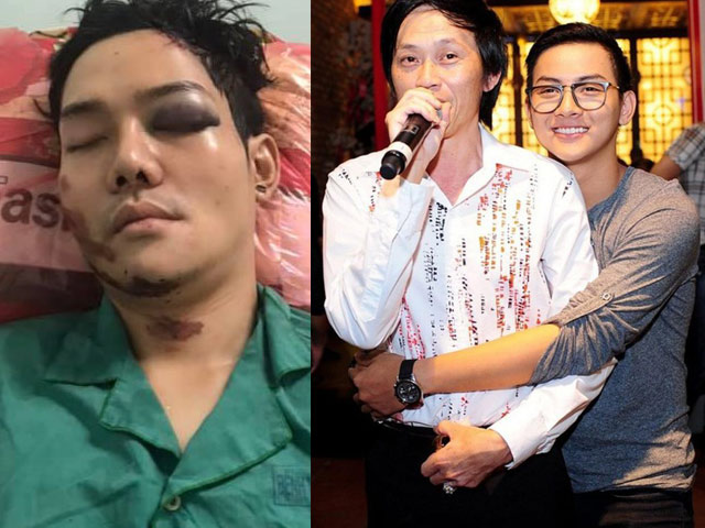 Ca nhạc - MTV - Con nuôi Hoài Linh: Người phải về quê chữa bệnh, kẻ gặp tai nạn khi làm shipper