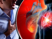 Sức khỏe đời sống - Trắc nghiệm: Muốn tránh căn bệnh &quot;sát thủ&quot; nguy hiểm nhất toàn cầu phải biết những điều này