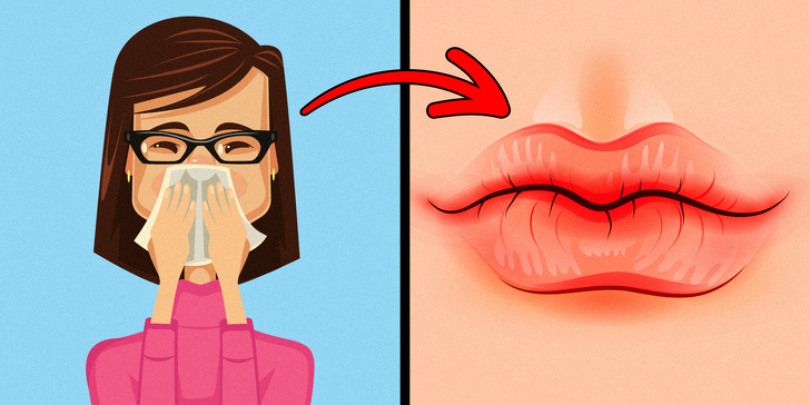 Chỉ cần nhìn 8 dấu hiệu này của môi, bạn có thể tự "bắt bệnh" cực chính xác - 2