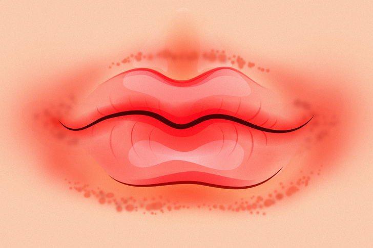 Chỉ cần nhìn 8 dấu hiệu này của môi, bạn có thể tự "bắt bệnh" cực chính xác - 4