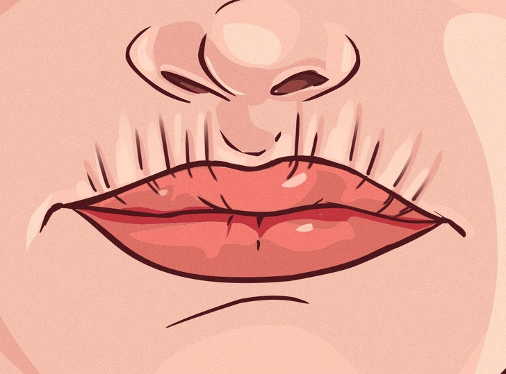 Chỉ cần nhìn 8 dấu hiệu này của môi, bạn có thể tự "bắt bệnh" cực chính xác - 5