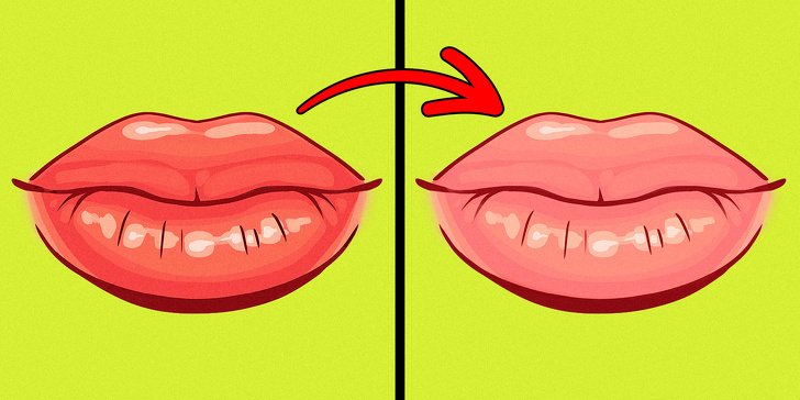 Chỉ cần nhìn 8 dấu hiệu này của môi, bạn có thể tự "bắt bệnh" cực chính xác - 6