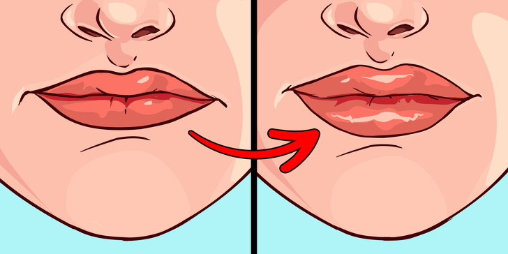 Chỉ cần nhìn 8 dấu hiệu này của môi, bạn có thể tự "bắt bệnh" cực chính xác - 7