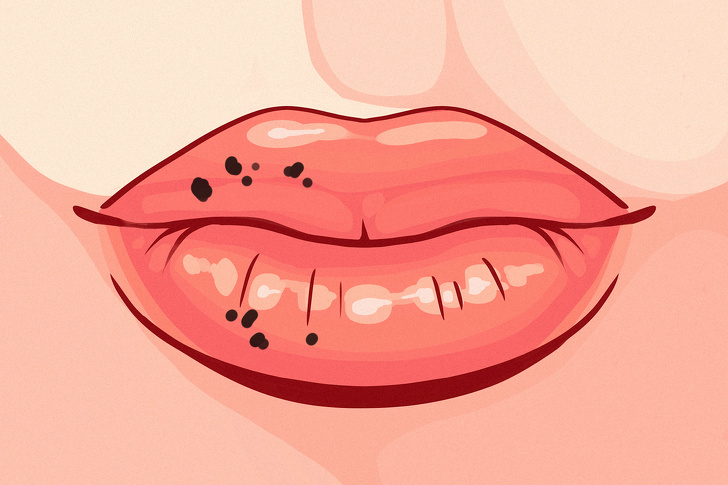 Chỉ cần nhìn 8 dấu hiệu này của môi, bạn có thể tự "bắt bệnh" cực chính xác - 8
