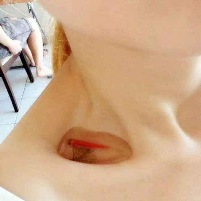 "Bể cá" trong hốc xương đòn là xu hướng phổ biến ở Trung Quốc để các cô gái thể hiện mình gầy như thế nào.
