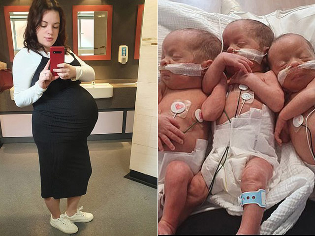 Bạn trẻ - Cuộc sống - Đi siêu âm ở tuần thứ 12, thai phụ nghe tin bất ngờ 200 triệu ca mới có một