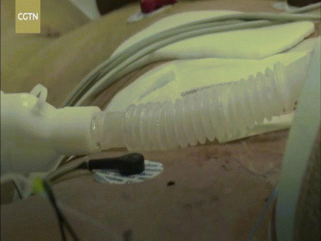 Thế giới - TQ: Bệnh nhân nhiễm Covid-19 được cứu sống ở “cửa tử”