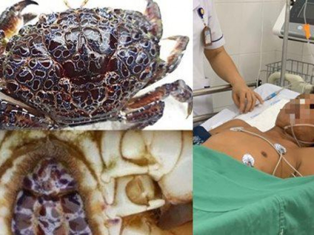 Phi thường - kỳ quặc - "Chén" phải cua mặt quỷ, người đàn ông suýt chết