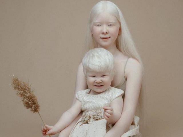 Bạn trẻ - Cuộc sống - Hai chị em bạch tạng "gây bão" thế giới vì đẹp phi thường và điều đặc biệt trong gia đình