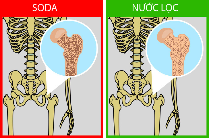 Coi chừng lợi ít hại nhiều khi sử dụng những &#34;siêu thực phẩm&#34; này - 3