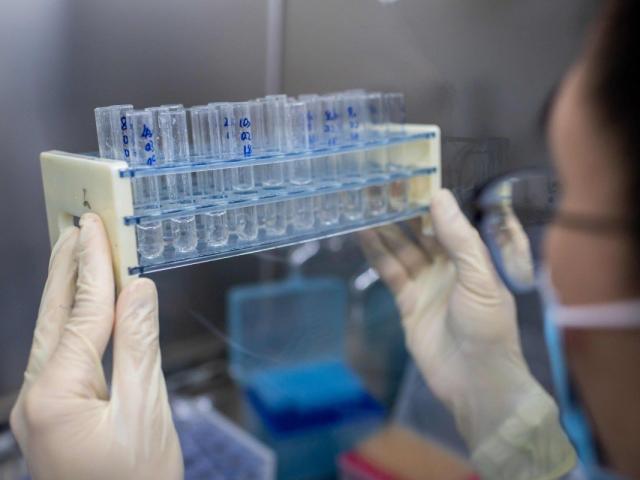 Thế giới - Phát hiện chủng virus giúp phản bác thuyết Covid-19 rò rỉ từ phòng thí nghiệm