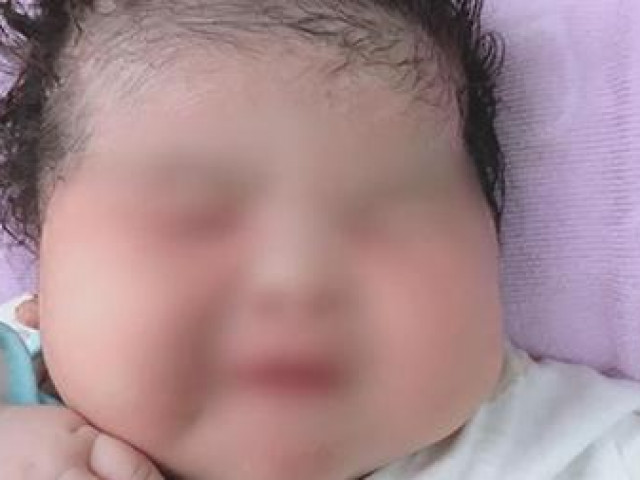 Sức khỏe đời sống - Bé gái sơ sinh ở Sóc Trăng nặng 6,1 kg