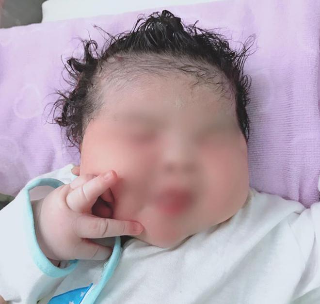 Bé gái sơ sinh ở Sóc Trăng nặng 6,1 kg - 1