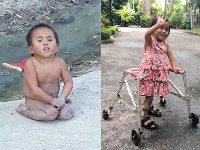 Bạn trẻ - Cuộc sống - Bé Pàng liệt 2 chân không manh áo giữa trời đông từng xôn xao MXH thay đổi đến ngỡ ngàng